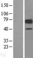 SLC22A2 Human Over-expression Lysate