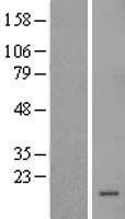 SLPI Human Over-expression Lysate