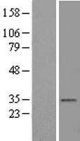 VDAC2 Human Over-expression Lysate