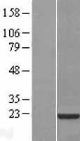 CNBP Human Over-expression Lysate