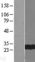 CDC34 Human Over-expression Lysate