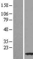 TBCA Human Over-expression Lysate