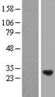SPAG7 Human Over-expression Lysate