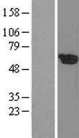 PLK1 Human Over-expression Lysate