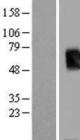 Tpit (TBX19) Human Over-expression Lysate