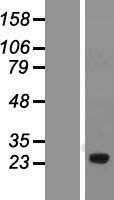 FGFBP1 Human Over-expression Lysate