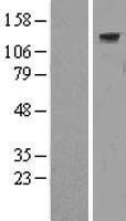 c Abl (ABL1) Human Over-expression Lysate