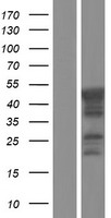 CHKL (CHKB) Human Over-expression Lysate