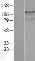 Hormone sensitive lipase (LIPE) Human Over-expression Lysate