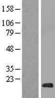 NHLH2 Human Over-expression Lysate