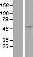 Legumain (LGMN) Human Over-expression Lysate