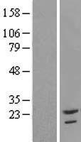 TAF12 Human Over-expression Lysate