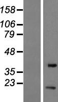 EIF1B Human Over-expression Lysate
