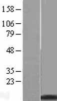 Metallothionein (MT2A) Human Over-expression Lysate
