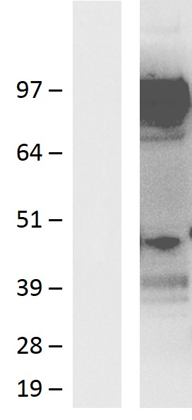 PCDHGA4 Human Over-expression Lysate