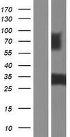 PDGF beta (PDGFB) Human Over-expression Lysate