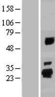(XM_114430) Human Over-expression LysateHuman Over-expression Lysate