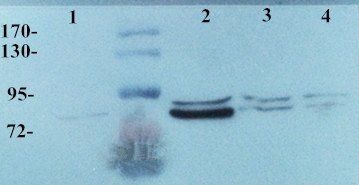 MMP9 antibody