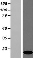Hbb-bt Mouse Over-expression Lysate