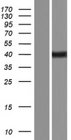 LIMS1 Human Over-expression Lysate
