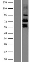 VIT Human Over-expression Lysate