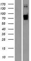 CPXM (CPXM1) Human Over-expression Lysate