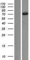 T Plastin (PLS3) Human Over-expression Lysate