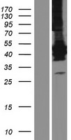 Lunatic Fringe (LFNG) Human Over-expression Lysate