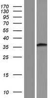 HCCA2 (MOB2) Human Over-expression Lysate