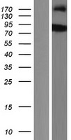 SH2B2 Human Over-expression Lysate