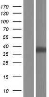 LIMS2 Human Over-expression Lysate