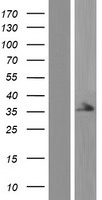 LYK5 (STRADA) Human Over-expression Lysate