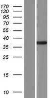 SEPTIN12 Human Over-expression Lysate