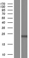 RAB28 Human Over-expression Lysate