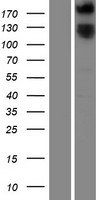 ROBO1 Human Over-expression Lysate