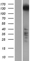 RRP12 Human Over-expression Lysate
