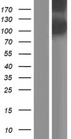 EYS Human Over-expression Lysate