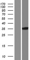 PRKRA Human Over-expression Lysate