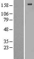 alpha 2 Macroglobulin (A2M) Human Over-expression Lysate