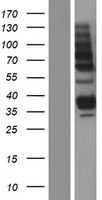 AGA Human Over-expression Lysate