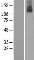 ATP7B Human Over-expression Lysate
