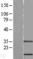 Stefin B (CSTB) Human Over-expression Lysate