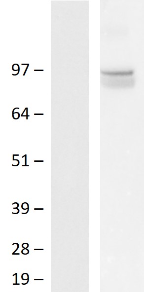 FGFR3 Human Over-expression Lysate