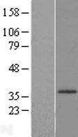 HSD17B3 Human Over-expression Lysate