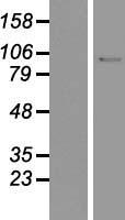 DNA Ligase I (LIG1) Human Over-expression Lysate
