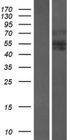 AIRE Human Over-expression Lysate