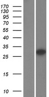 SHOX Human Over-expression Lysate