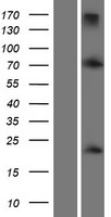 Twist (TWIST1) Human Over-expression Lysate