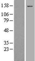 Collagen XVII (COL17A1) Human Over-expression Lysate