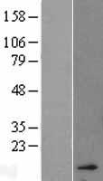 HBA2 Human Over-expression Lysate